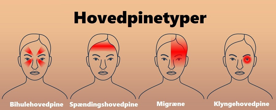 Naturlig hovedpine behandling: 7 metoder der lindrer spændinger hurtigt og effektivt